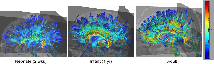 fibertracts develpmentstudy