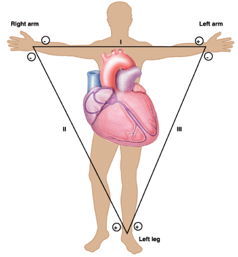 ECG limb leads