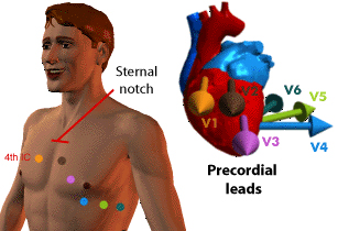 precordial.jpg