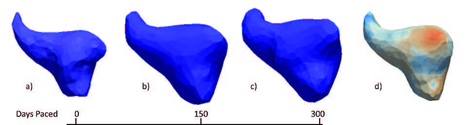 Afib3