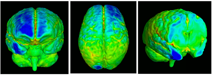 brain growth map