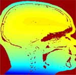 mri-epi figure-2