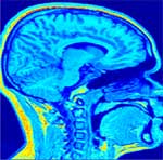 mri-epi figure-3