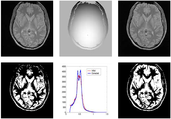 mri-epi figure-set