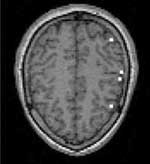 fig3 mri