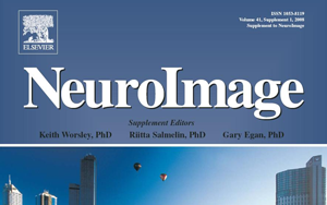 neuroimage