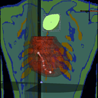 scirun tutorial defib