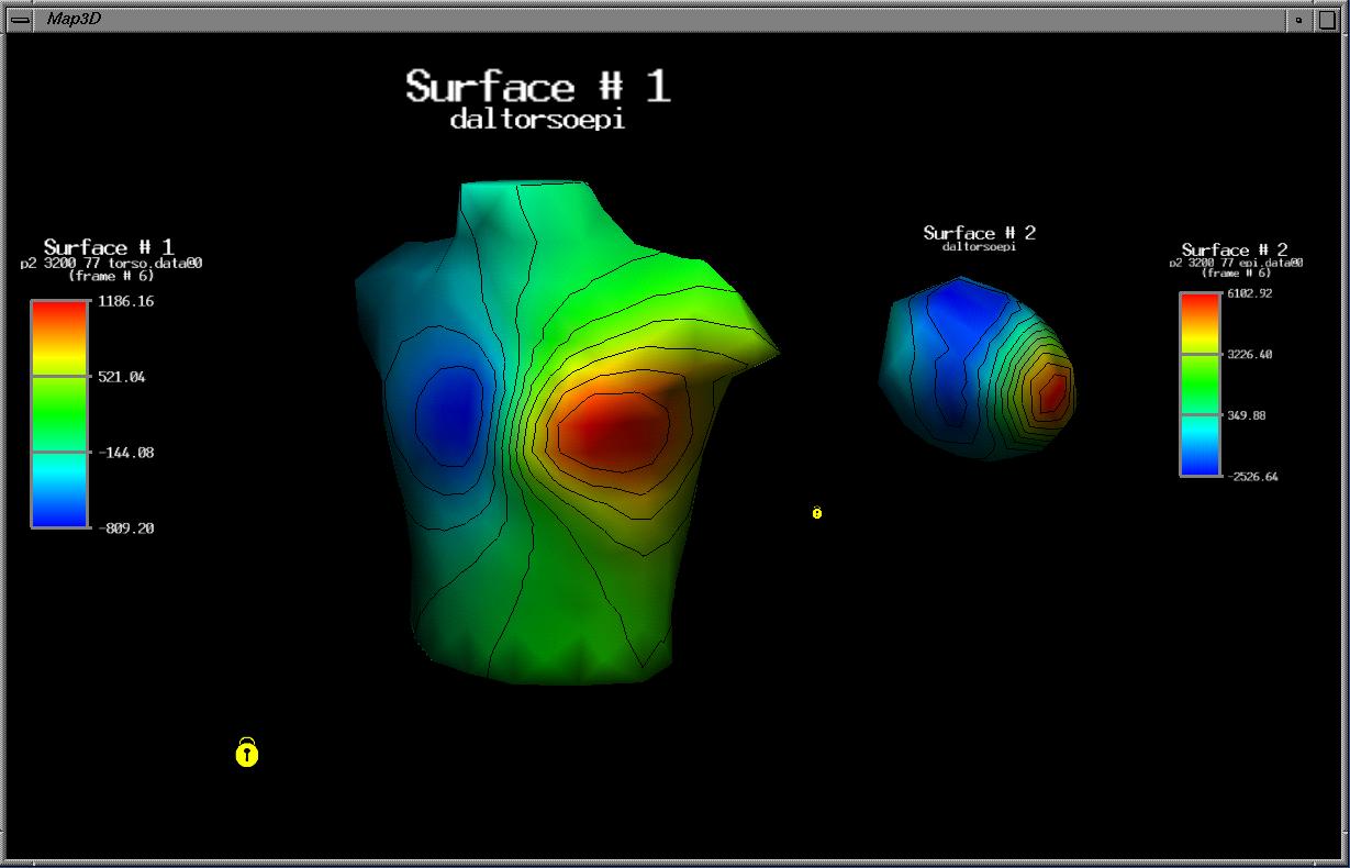 HeartAndTorso2
