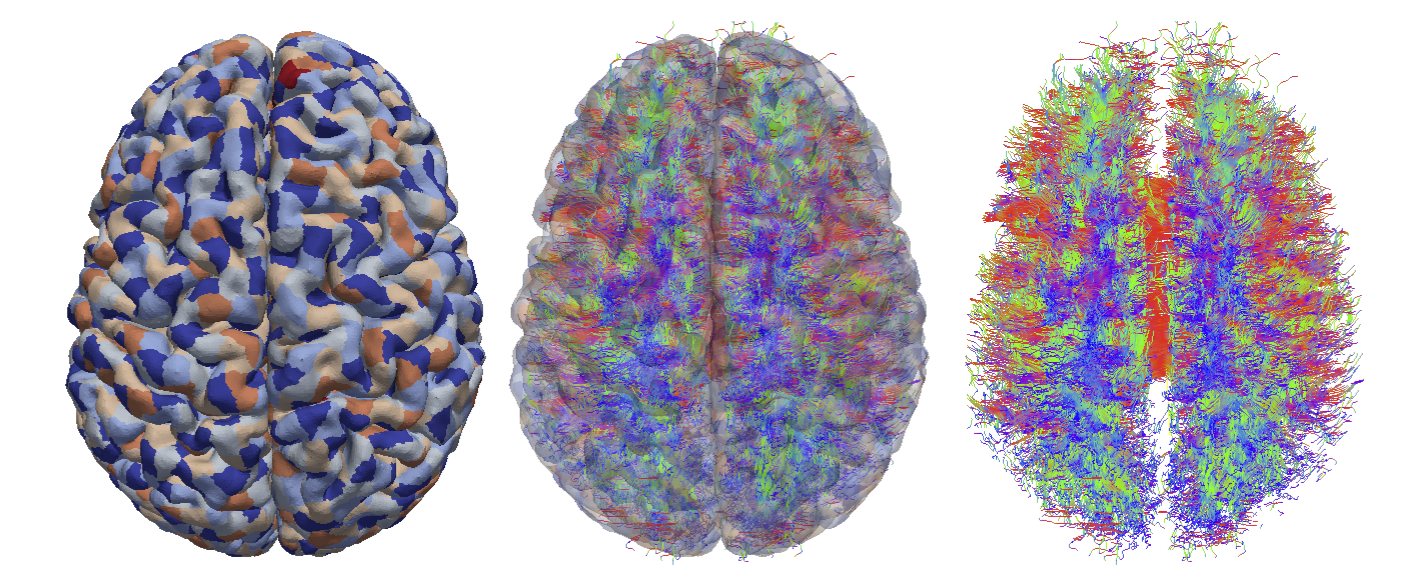 egi3brains