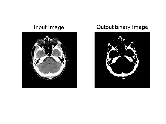 ctscan_seg