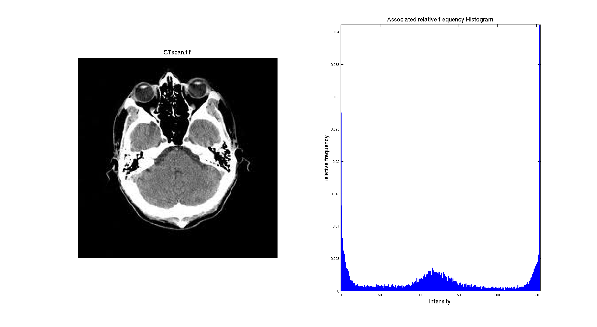 histogram_ctscan_125