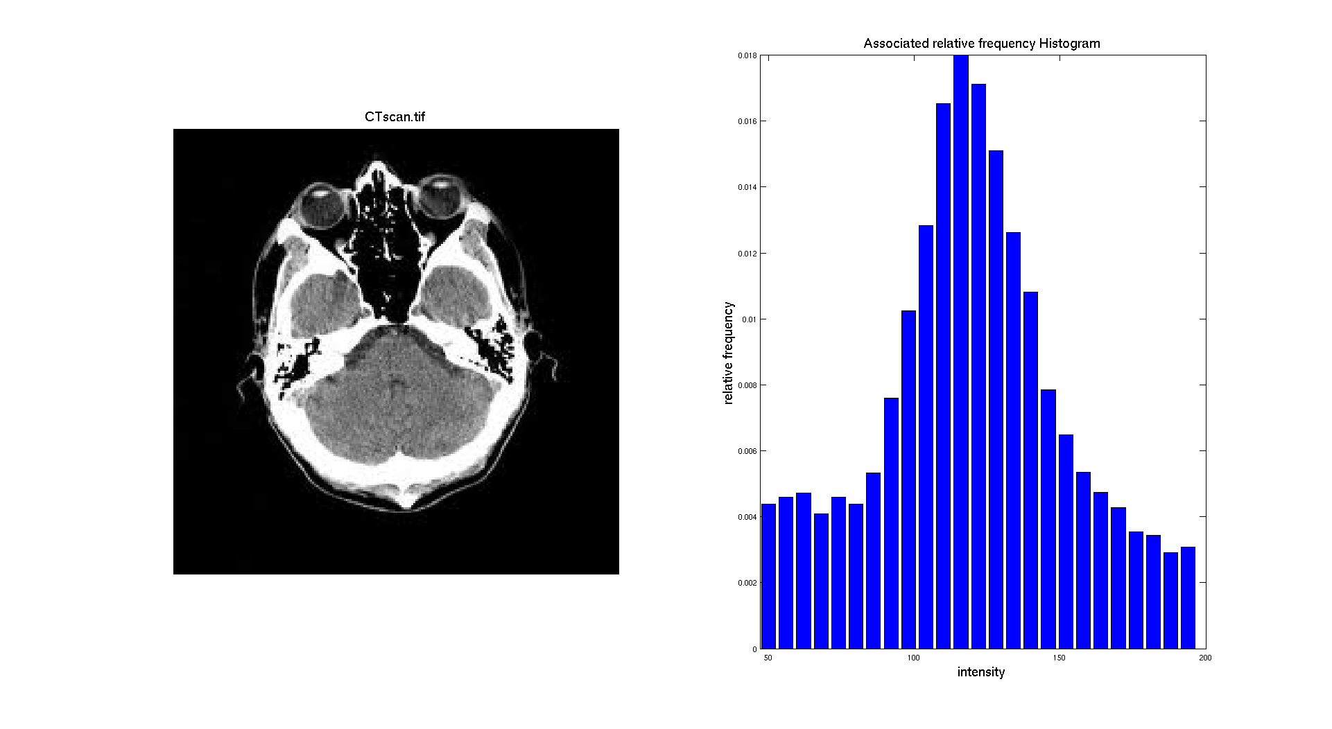 histogram_ctscan_125_ranged