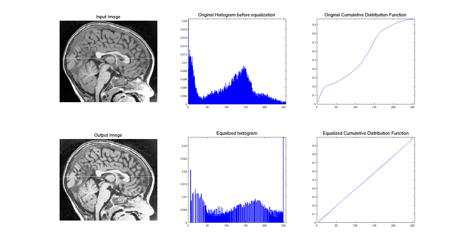 equalizationmri