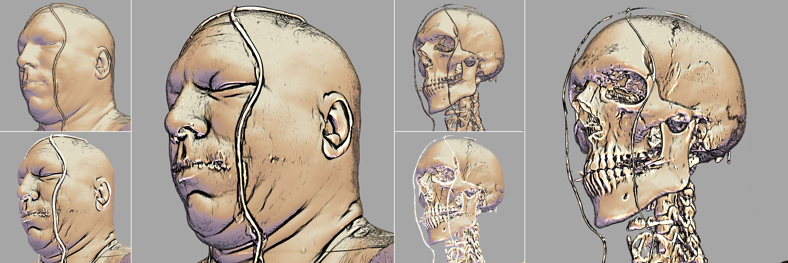_vmhead.png