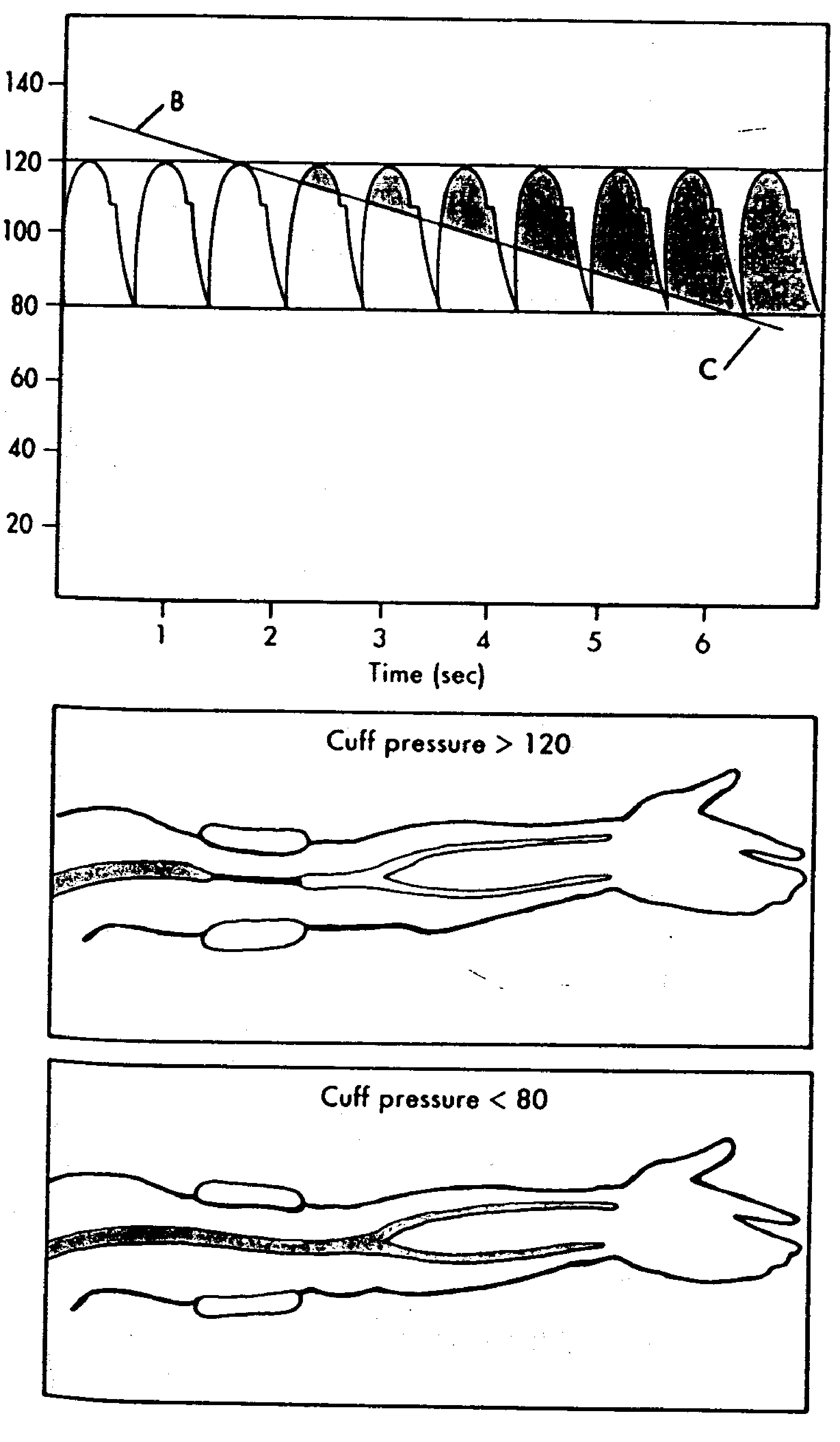 Blood pressure