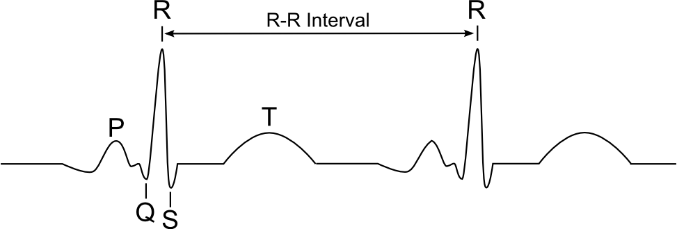 ecg-lead2.png