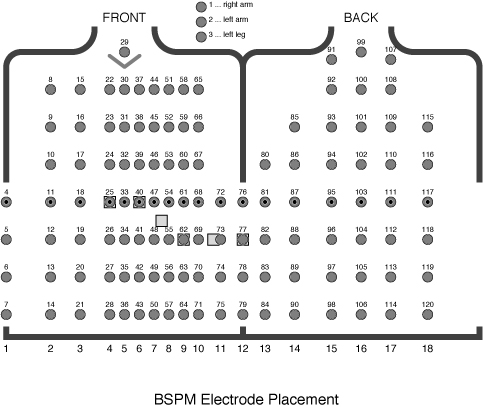 bspm_elect_port.jpg