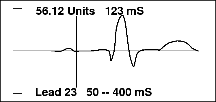 \begin{figure}\centerline{\epsfig{file=figures/scalar.epsf,width=6.5in}} \end{figure}