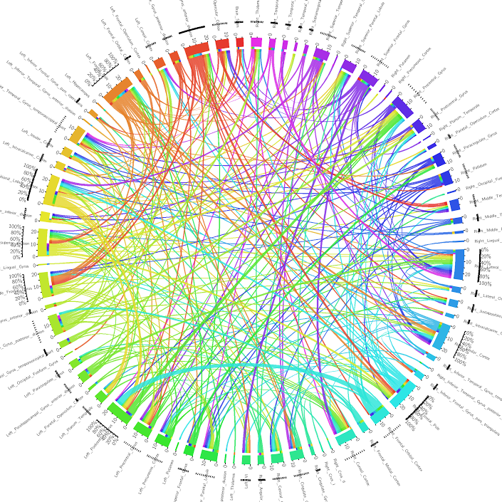 Autism patient brain connectivity